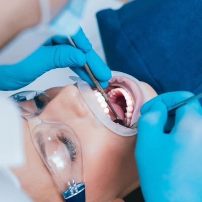 Dental Fillings