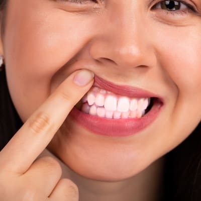 Soft Tissue Laser
